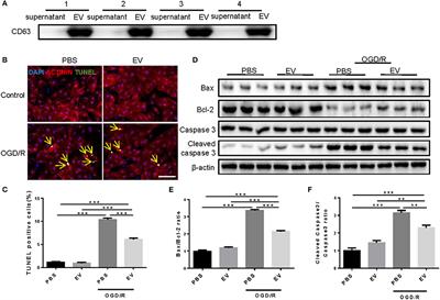 Serum-Derived Extracellular Vesicles Protect Against Acute Myocardial Infarction by Regulating miR-21/PDCD4 Signaling Pathway